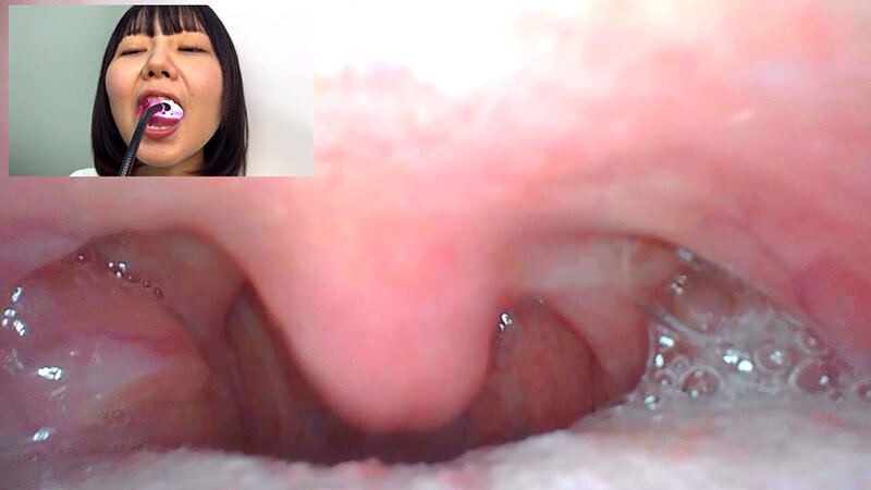 街角で声をかけて口内観察させてもらう テレビ局AD みゆりちゃん サンプル 13