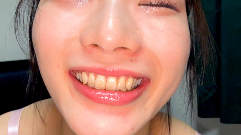 器用な長舌！ゆいなちゃんの口内観察 サンプル 17