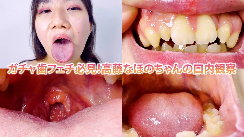 ガチャ歯フェチ必見！高藤なほのちゃんの口内観察