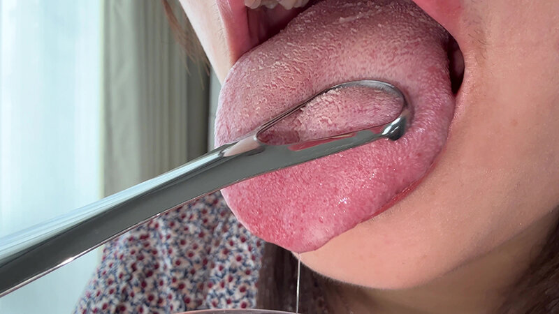 【個人撮影】水月みおの舌ブラシで「汚舌苔」採取 サンプル 8