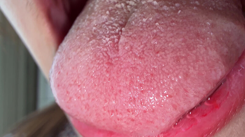 【個人撮影】水月みおの舌ブラシで「汚舌苔」採取 サンプル 12
