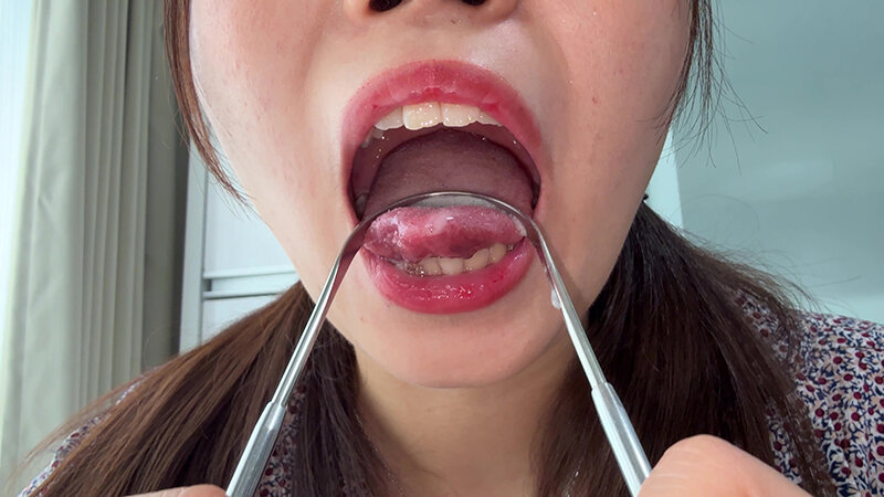 【個人撮影】水月みおの舌ブラシで「汚舌苔」採取 サンプル 15