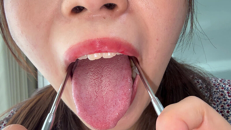 【個人撮影】水月みおの舌ブラシで「汚舌苔」採取 サンプル 16