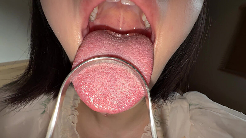 【個人撮影】大園明歩の舌ブラシで「汚舌苔」採取 サンプル 15