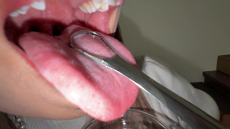 【個人撮影】若菜めありの舌ブラシで「汚舌苔」採取 サンプル 9