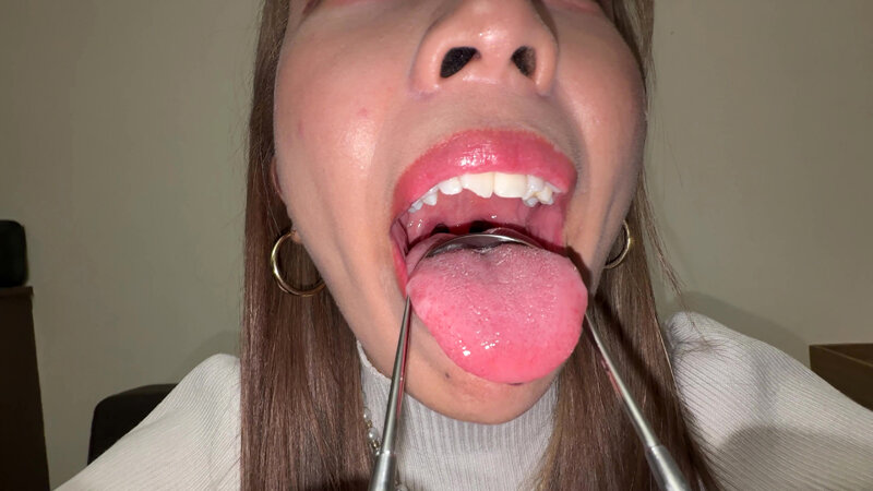 【個人撮影】若菜めありの舌ブラシで「汚舌苔」採取 サンプル 16