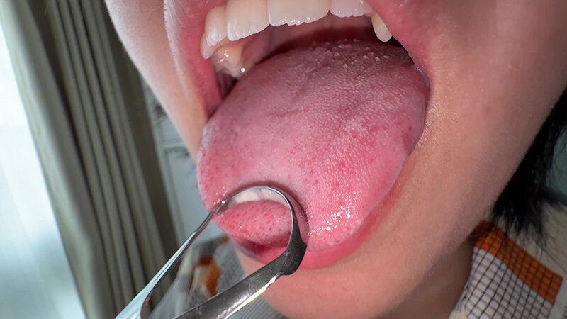 【個人撮影】加護まりの舌ブラシで「汚舌苔」採取 サンプル 5