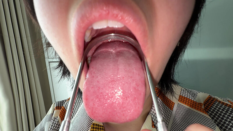 【個人撮影】加護まりの舌ブラシで「汚舌苔」採取 サンプル 14