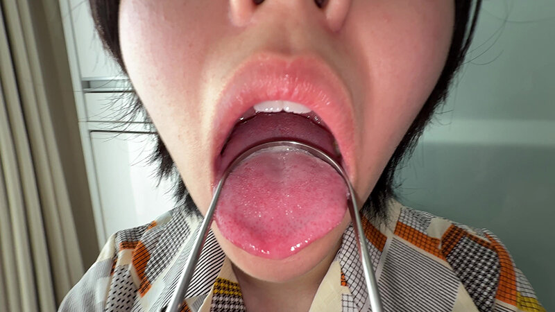 【個人撮影】加護まりの舌ブラシで「汚舌苔」採取 サンプル 15