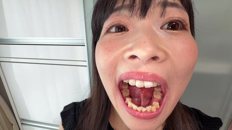 【個人撮影】原美織の舌ブラシで「汚舌苔」採取 サンプル 3