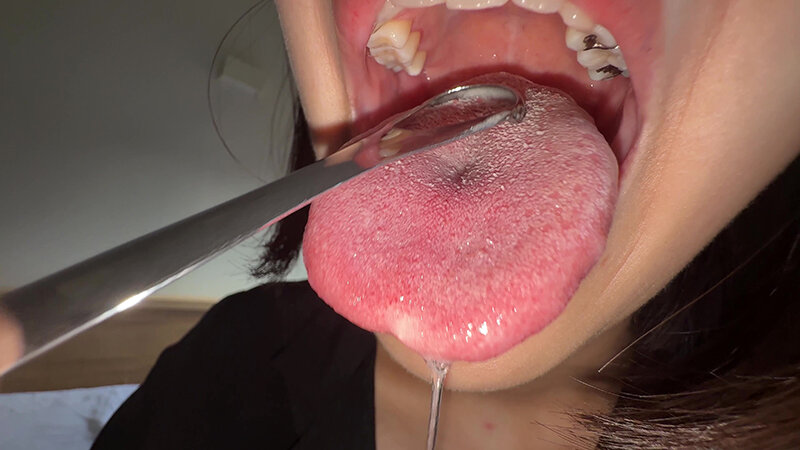 【個人撮影】湊波流の舌ブラシで「汚舌苔」採取！ サンプル 12
