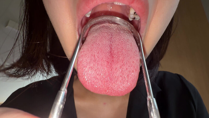 【個人撮影】湊波流の舌ブラシで「汚舌苔」採取！ サンプル 17