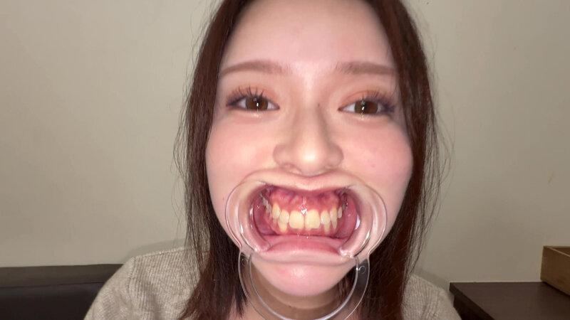【個人撮影】彩川ゆめの喉チン触り＆開口器Wピース サンプル 14