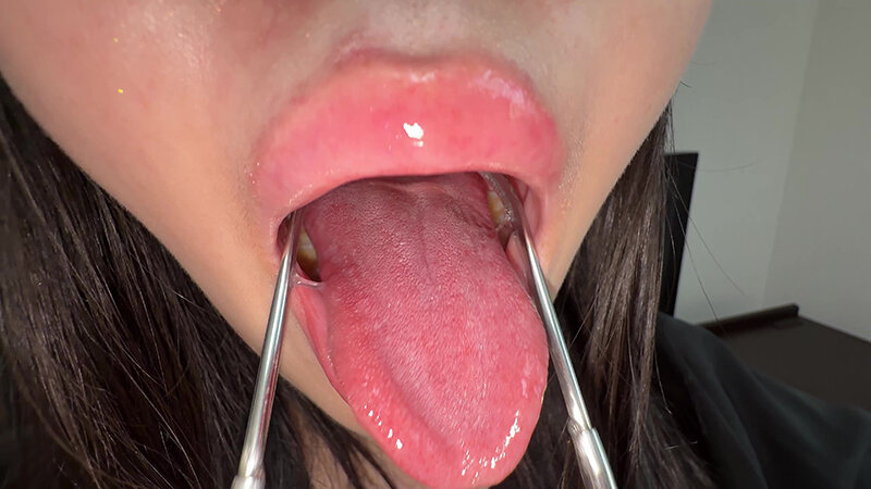 【個人撮影】ゆうきすずの舌ブラシで「汚舌苔」採取 サンプル 14