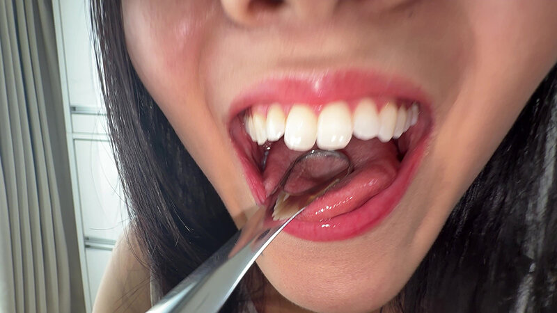 【個人撮影】桃瀬まゆの舌ブラシで「汚舌苔」採取 サンプル 6