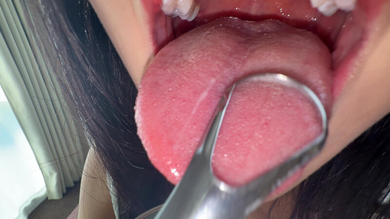 【個人撮影】桃瀬まゆの舌ブラシで「汚舌苔」採取 サンプル 8