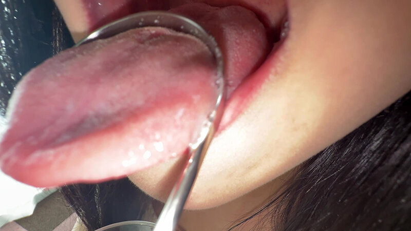 【個人撮影】桃瀬まゆの舌ブラシで「汚舌苔」採取 サンプル 11