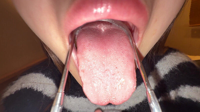 【個人撮影】さくまつなの舌ブラシで「汚舌苔」採取 サンプル 17