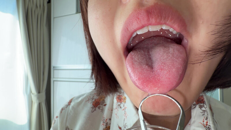 【個人撮影】浅桜エリの舌ブラシで「汚舌苔」採取 サンプル 7