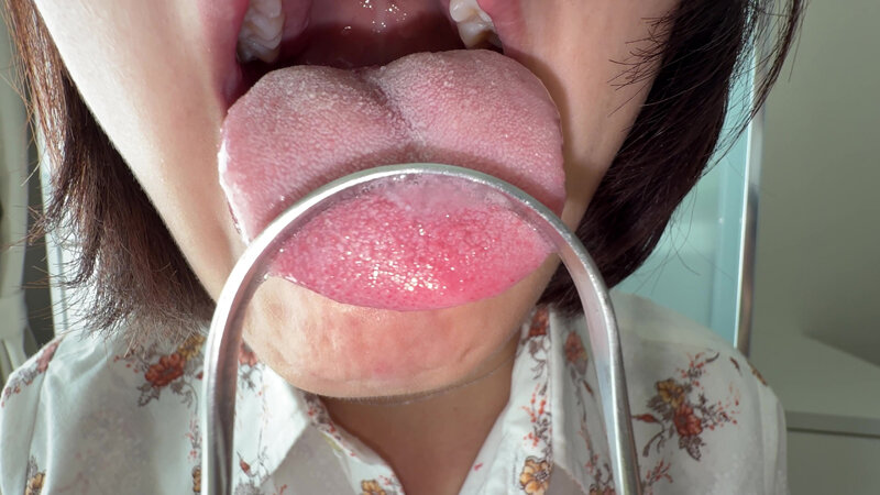 【個人撮影】浅桜エリの舌ブラシで「汚舌苔」採取 サンプル 18