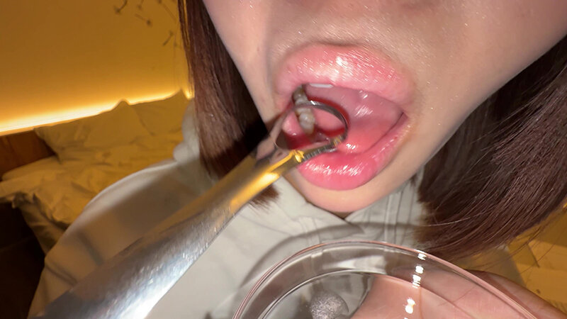 【個人撮影】渡来ふうの舌ブラシで「汚舌苔」採取 サンプル 7