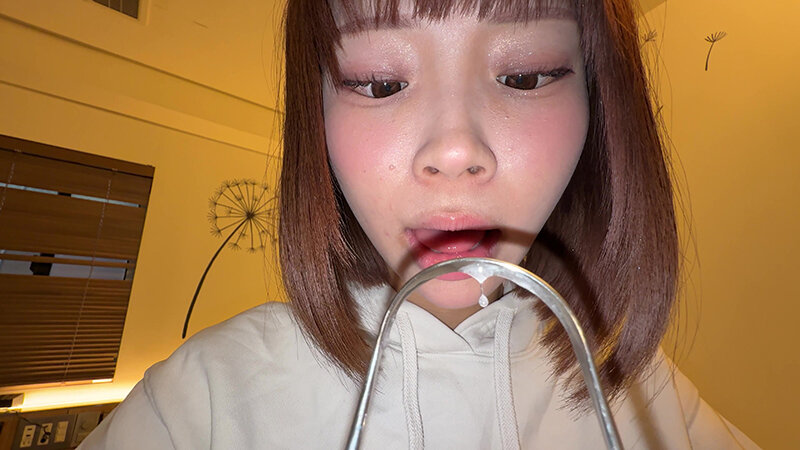 【個人撮影】渡来ふうの舌ブラシで「汚舌苔」採取 サンプル 13