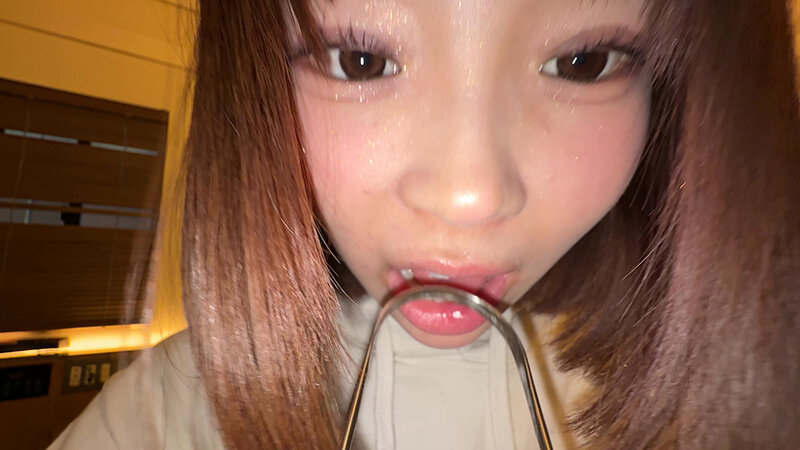 【個人撮影】渡来ふうの舌ブラシで「汚舌苔」採取 サンプル 15