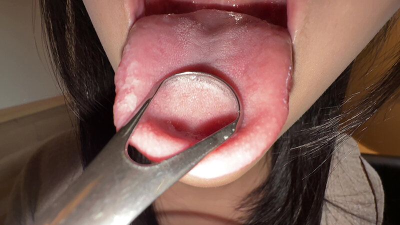 【個人撮影】音羽美鈴の舌ブラシで「汚舌苔」採取 サンプル 8