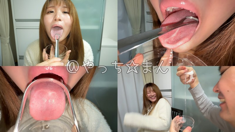【個人撮影】宮ノ木しゅんかの舌ブラシで「汚舌苔」採取